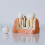 Zähne weiß bekommen mit natürlichen Mitteln