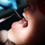 Gelbe Zähne aufhellen - Tipps und Tricks