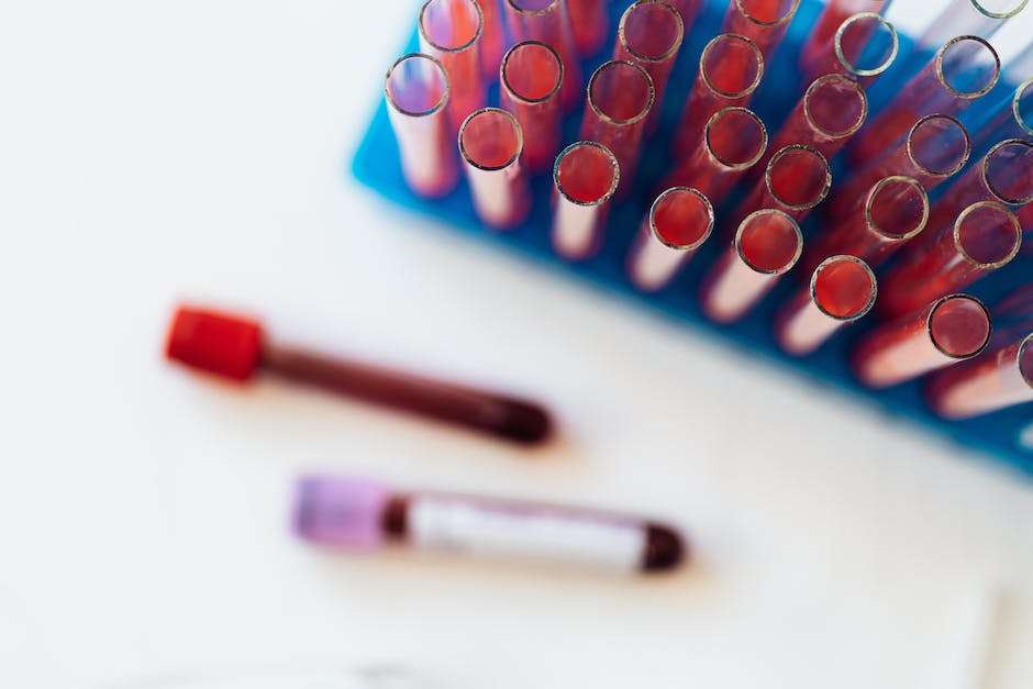  Blutgruppenbestimmung - Wie finde ich meine Blutgruppe?